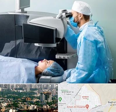مرکز لیزیک چشم در عظیمیه کرج