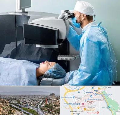مرکز لیزیک چشم در معالی آباد شیراز