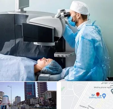 مرکز لیزیک چشم در چهارراه طالقانی کرج