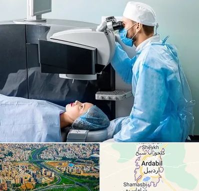 مرکز لیزیک چشم در اردبیل
