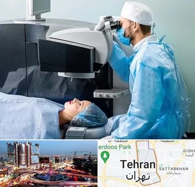 مرکز لیزیک چشم در صادقیه تهران