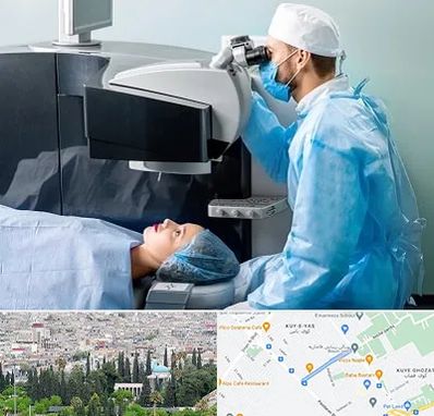مرکز لیزیک چشم در محلاتی شیراز