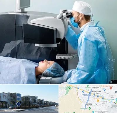 مرکز لیزیک چشم در شریعتی مشهد