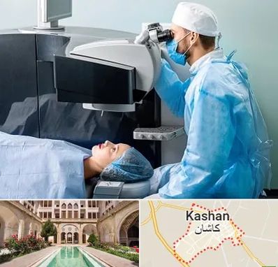 مرکز لیزیک چشم در کاشان