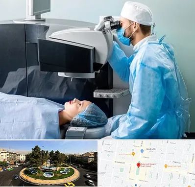 مرکز لیزیک چشم در هفت حوض