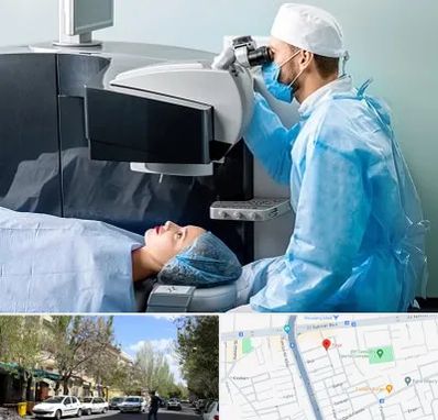 مرکز لیزیک چشم در کوی فیروز تبریز