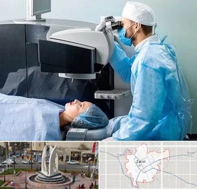 مرکز لیزیک چشم در زابل