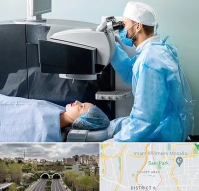 مرکز لیزیک چشم در یوسف آباد