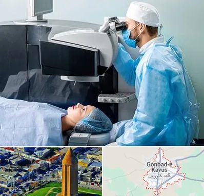 مرکز لیزیک چشم در گنبد کاووس