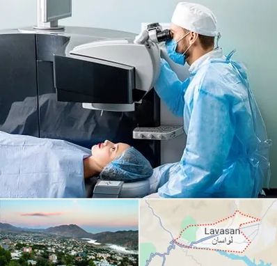 مرکز لیزیک چشم در لواسان
