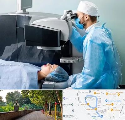 مرکز لیزیک چشم در فلکه گاز رشت