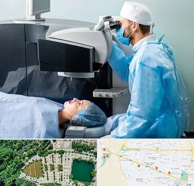 مرکز لیزیک چشم در وکیل آباد مشهد