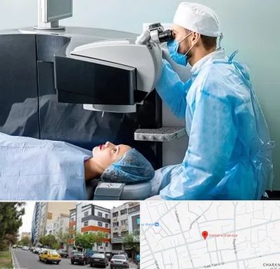 مرکز لیزیک چشم در هفده شهریور تبریز