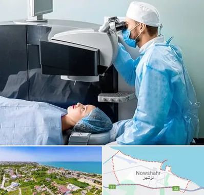 مرکز لیزیک چشم در نوشهر