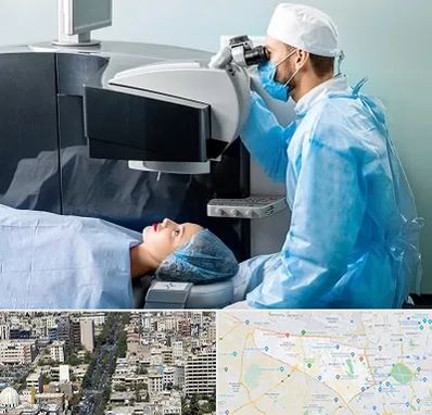 مرکز لیزیک چشم در منطقه 18 تهران