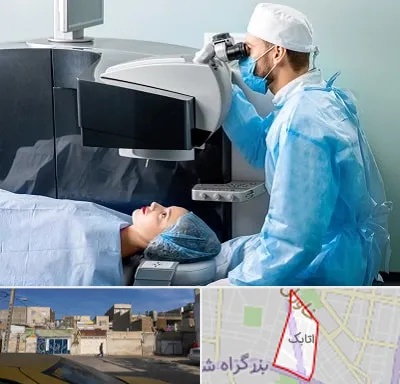 مرکز لیزیک چشم در اتابک