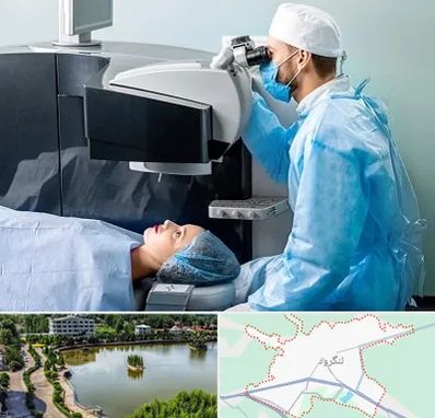 مرکز لیزیک چشم در لنگرود