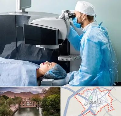 مرکز لیزیک چشم در دامغان