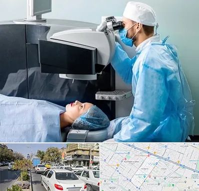 مرکز لیزیک چشم در مفتح مشهد