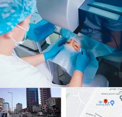 دکتر عمل لازک چشم در چهارراه طالقانی کرج