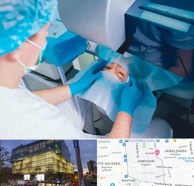 دکتر عمل لازک چشم در جمهوری