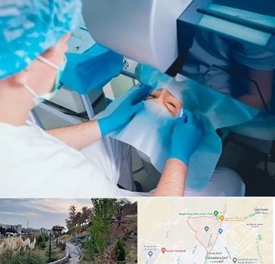 دکتر عمل لازک چشم در باغستان کرج