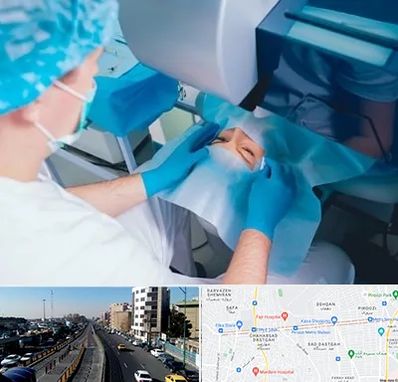 دکتر عمل لازک چشم در پیروزی