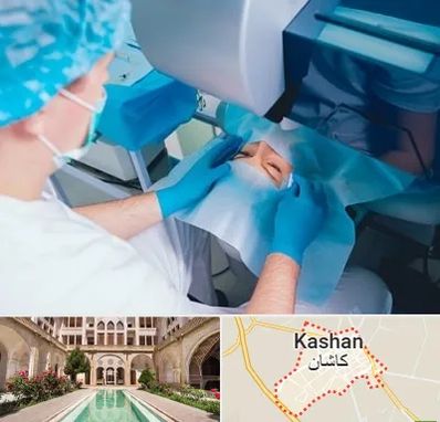 دکتر عمل لازک چشم در کاشان