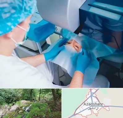 دکتر عمل لازک چشم در آزادشهر