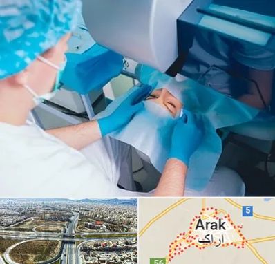 دکتر عمل لازک چشم در اراک