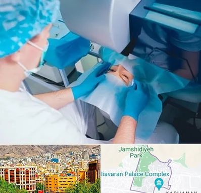 دکتر عمل لازک چشم در نیاوران