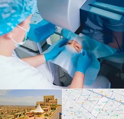 دکتر عمل لازک چشم در هاشمیه مشهد