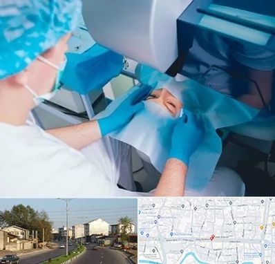 دکتر عمل لازک چشم در ضیابری رشت
