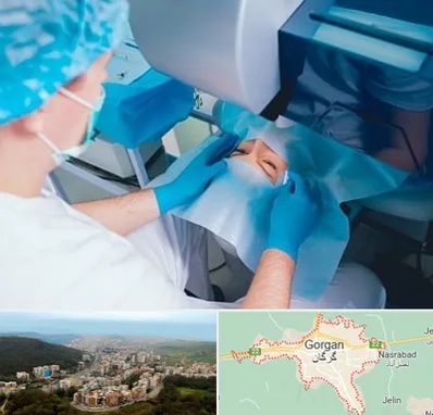 دکتر عمل لازک چشم در گرگان