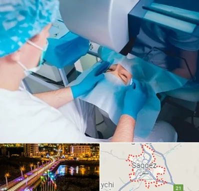 دکتر عمل لازک چشم در سقز