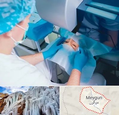 دکتر عمل لازک چشم در میگون