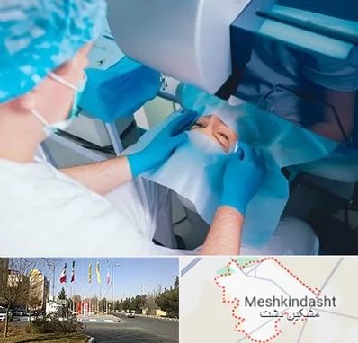 دکتر عمل لازک چشم در مشکین دشت
