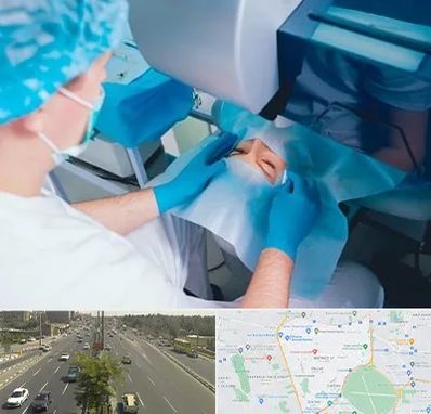 دکتر عمل لازک چشم در منطقه 17 تهران