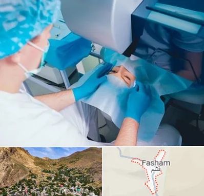 دکتر عمل لازک چشم در فشم