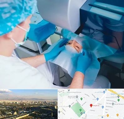 دکتر عمل لازک چشم در هنگام