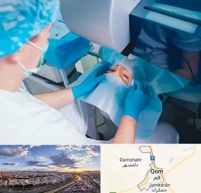 دکتر عمل لازک چشم در قم
