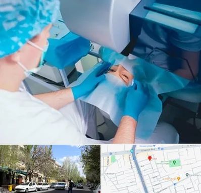 دکتر عمل لازک چشم در کوی فیروز تبریز