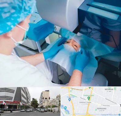 دکتر عمل لازک چشم در بلوار فردوس