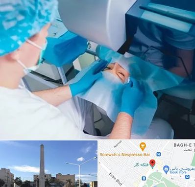 دکتر عمل لازک چشم در فلکه گاز شیراز