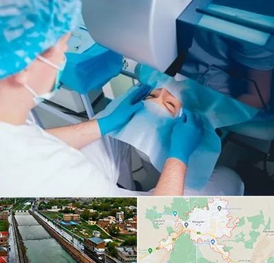 دکتر عمل لازک چشم در مراغه