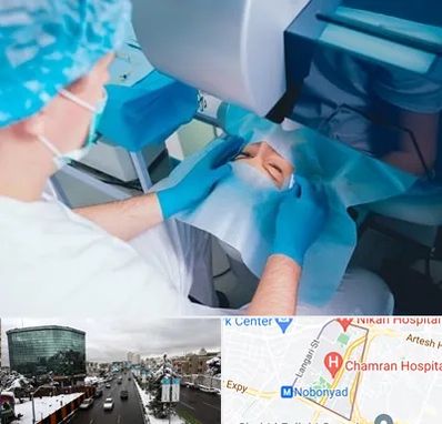 دکتر عمل لازک چشم در اقدسیه