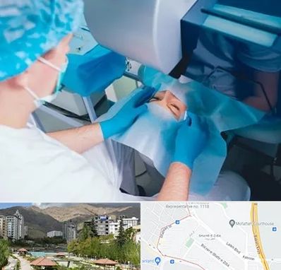 دکتر عمل لازک چشم در شهر زیبا