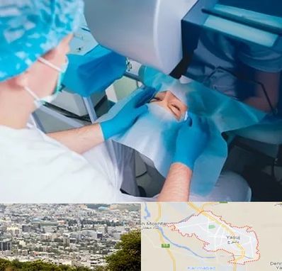 دکتر عمل لازک چشم در یاسوج