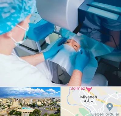 دکتر عمل لازک چشم در میانه