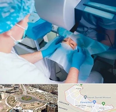 دکتر عمل لازک چشم در پرند